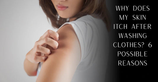 Why Does My Skin Itch After Washing Clothes? 6 Possible Reasons | PureOnSkin