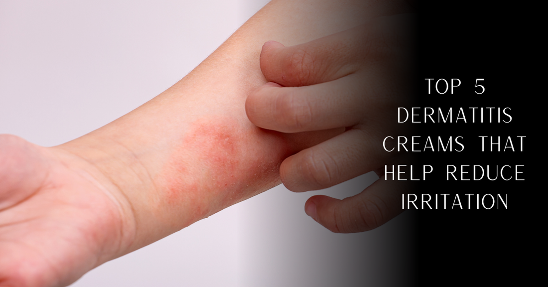 Top 5 Dermatitis Creams That Help Reduce Irritation | PureOnSkin
