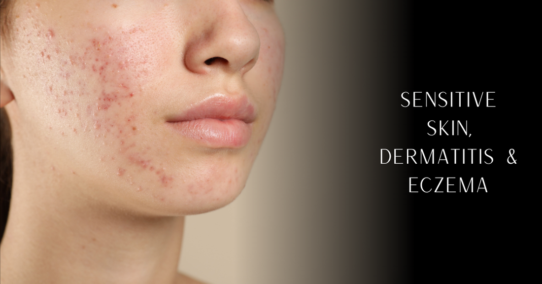 Sensitive Skin, Dermatitis & Eczema: Choosing Clothes, Blankets and Home Essentials for Allergy-Prone Skin