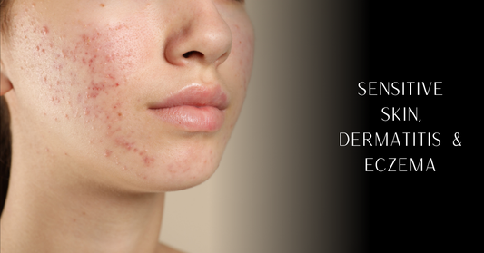 Sensitive Skin, Dermatitis & Eczema: Choosing Clothes, Blankets and Home Essentials for Allergy-Prone Skin